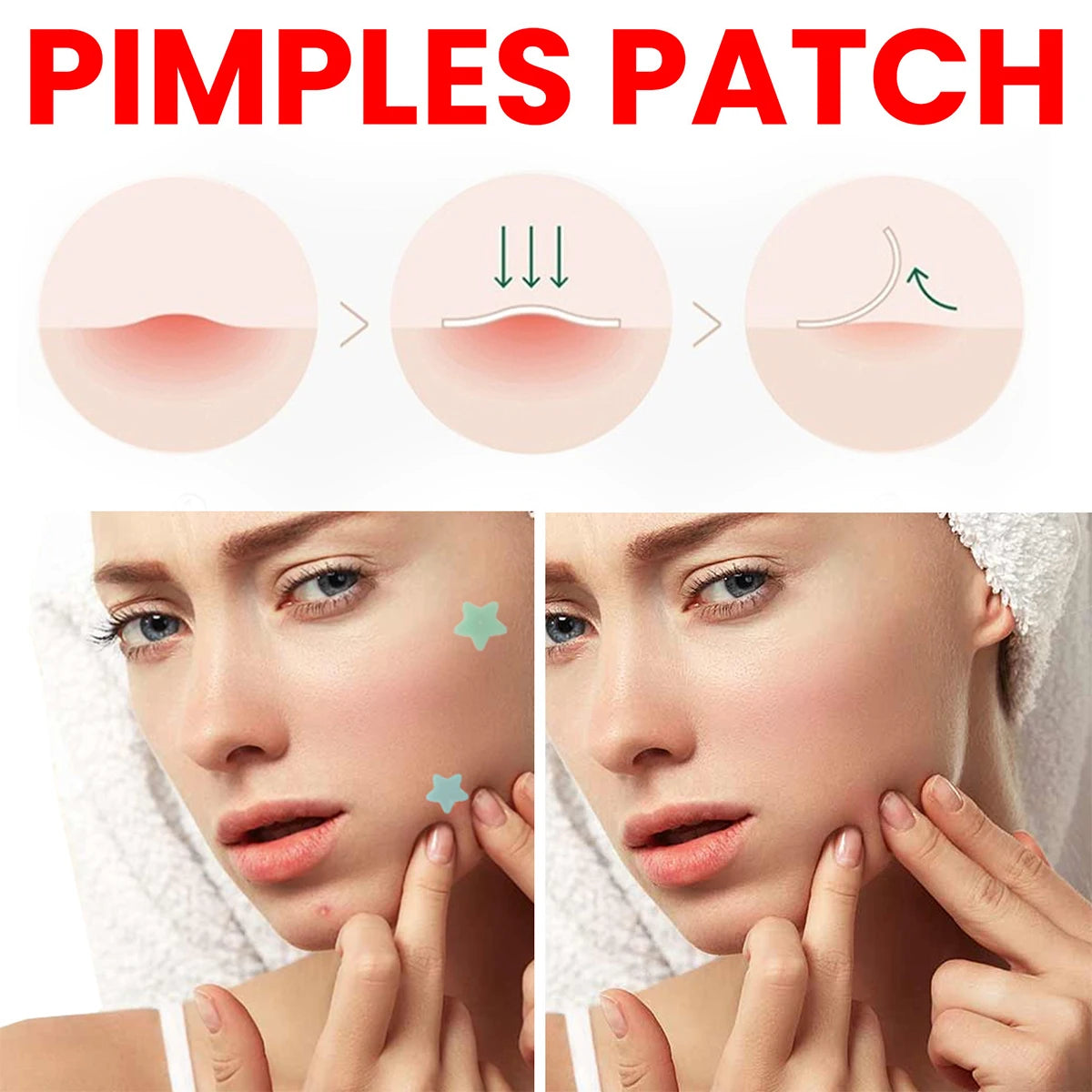 200 Star Shape Pimple Patches